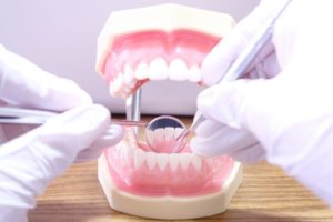 入れ歯（義歯）治療が見直されています。