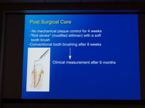 歯周組織再生療法の講習会