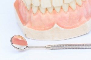 歯周再生治療